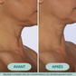 [FR]