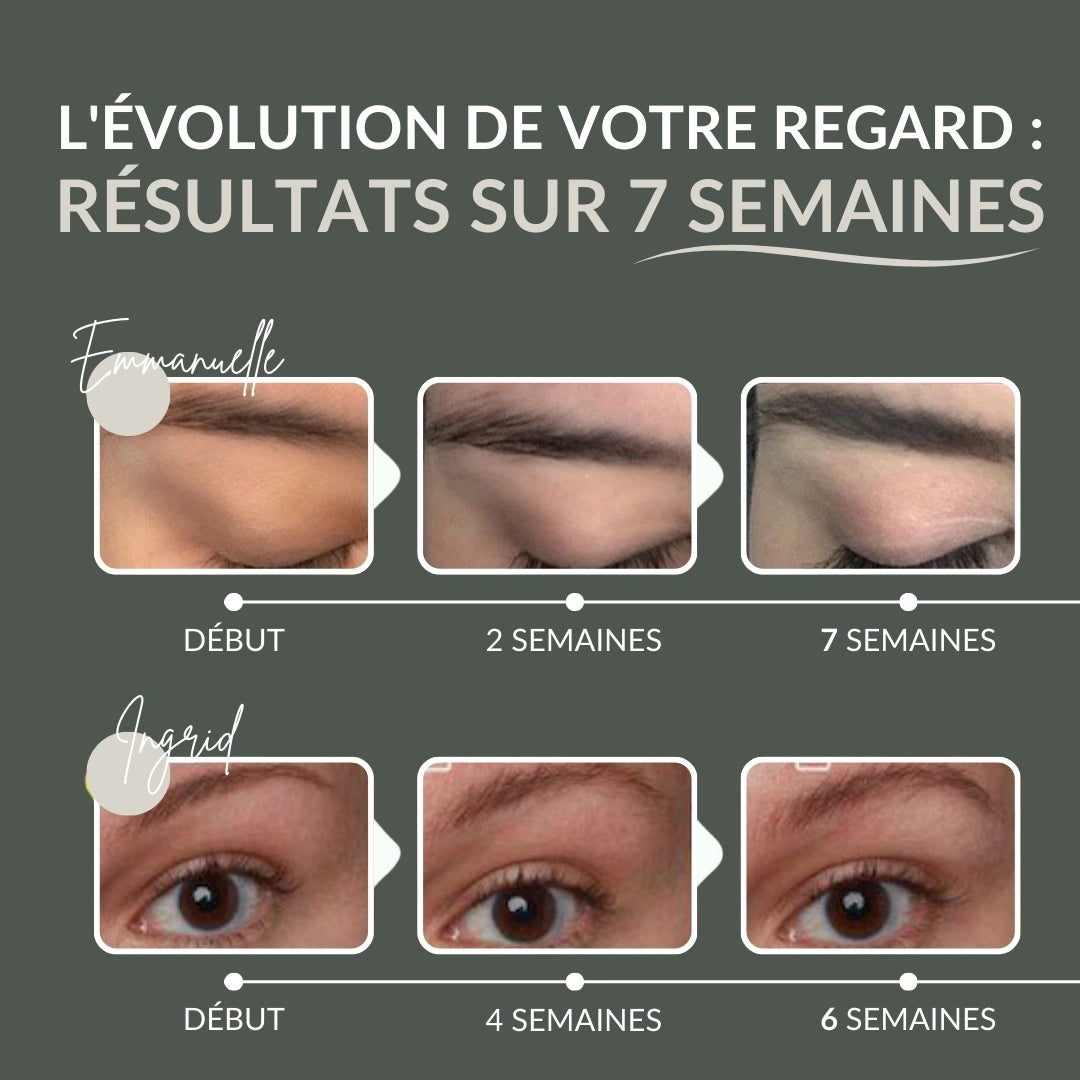 [FR]