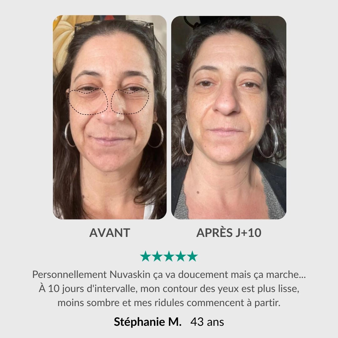 [FR]